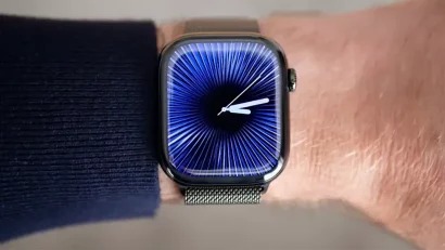 Apple Watch više nije samo obični, pametni sat